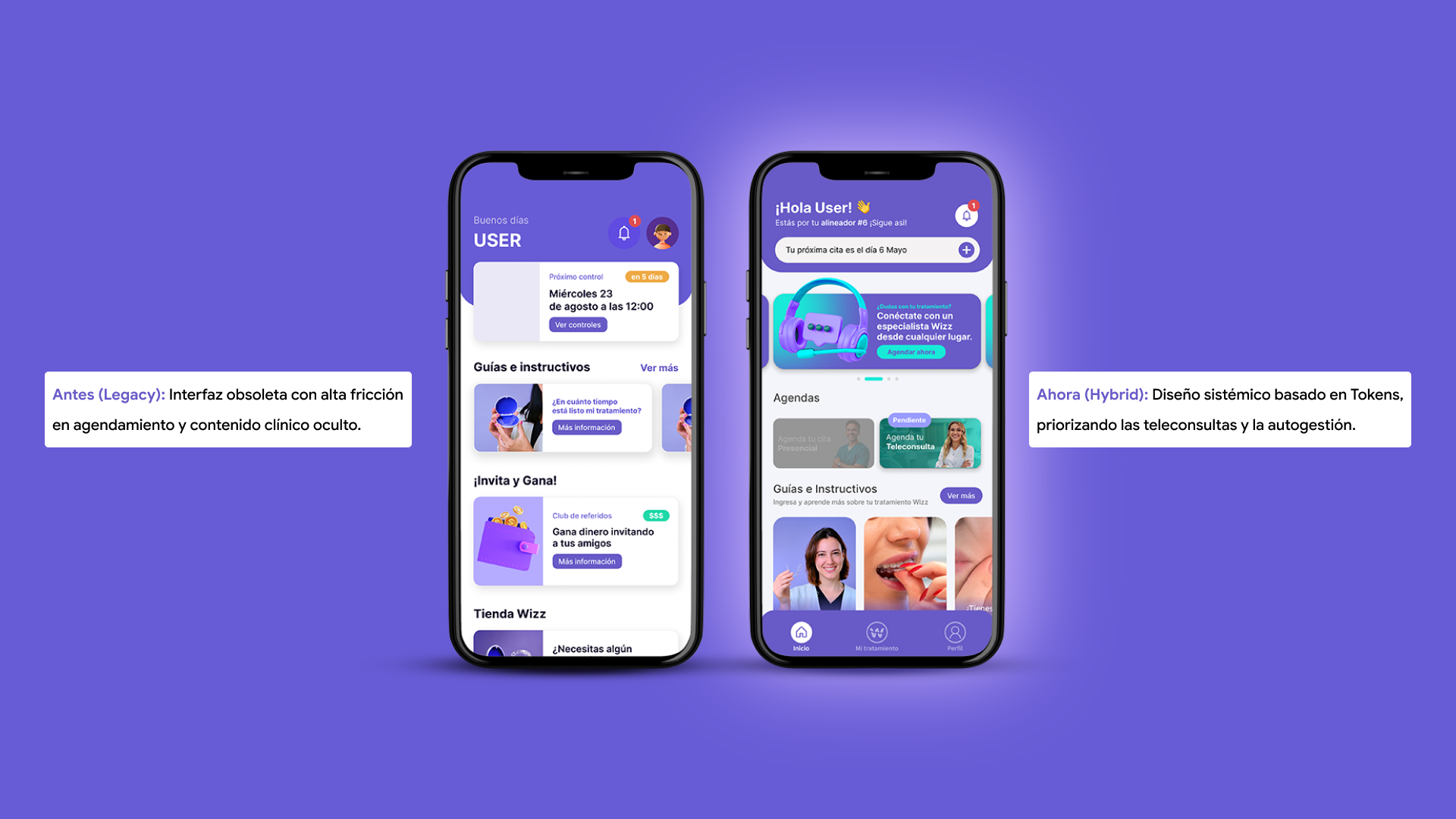 Comparativa Legacy vs. Nueva Propuesta Visual