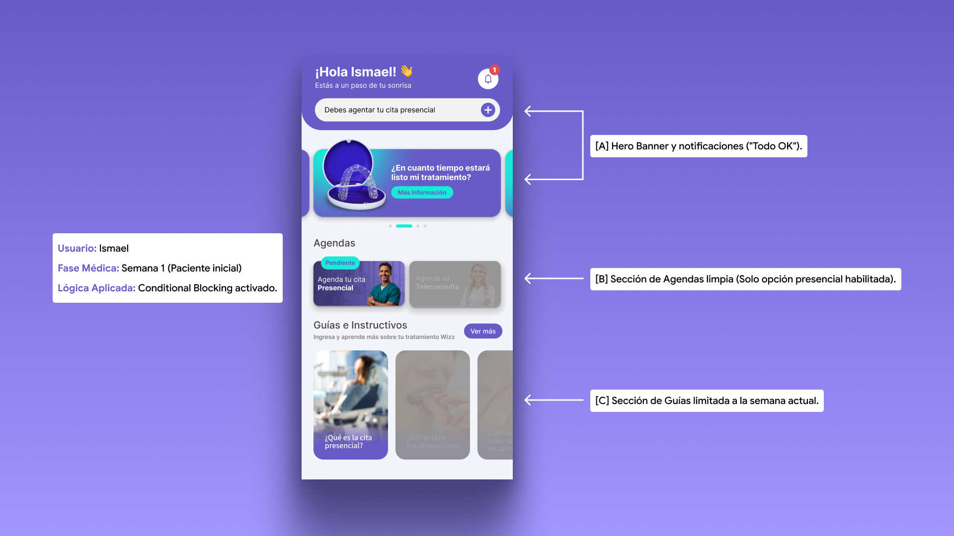 Exploded View — vista 1