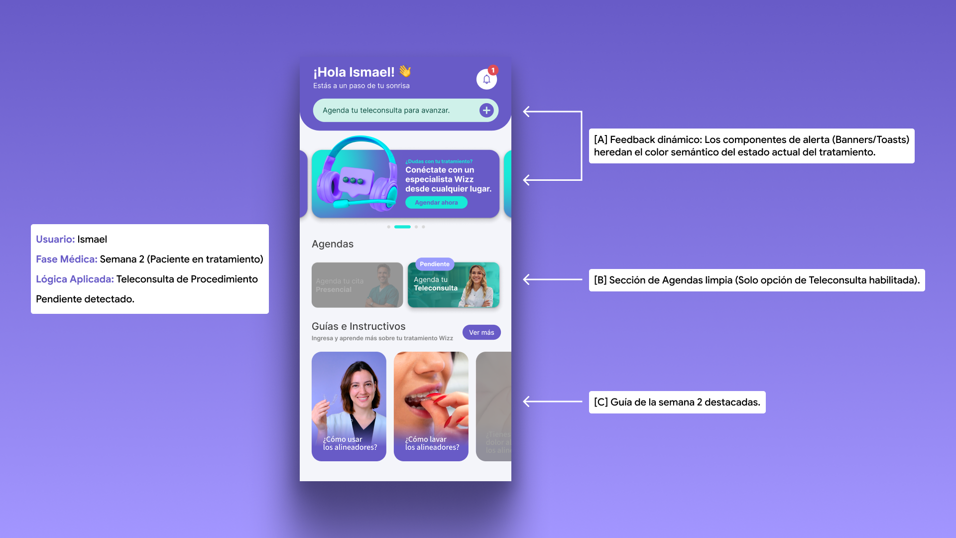 Exploded View — vista 2